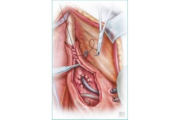BAUS Cadaveric Emergency Urology Surgery 